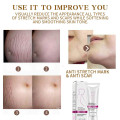 Reliable Quality Surgical Removal Cream Whitening Stretch Marks Remover Cream V7 Toning Light Whitening Body Cream